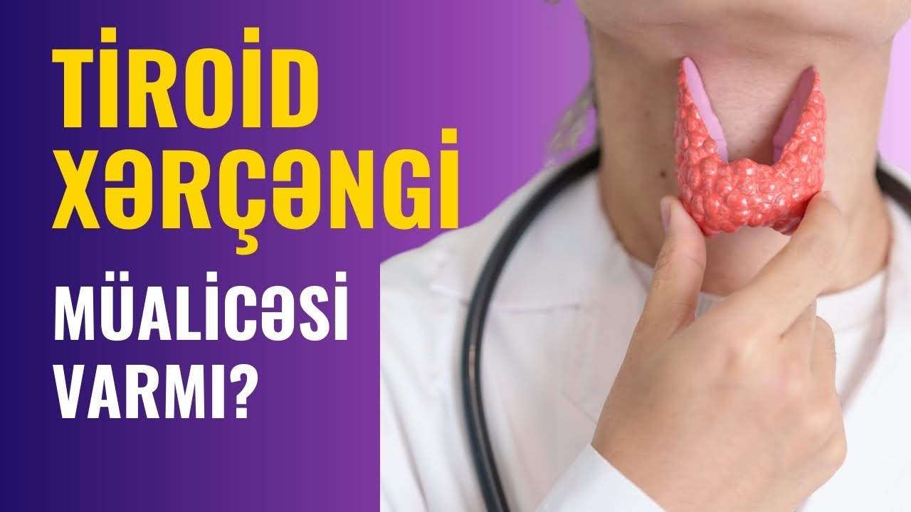 TİROİD XƏRÇƏNGİ | Onkoloq-Mammoloq İndira Səfərova