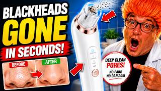 Unboxing the blackhead remover, I'm impressed