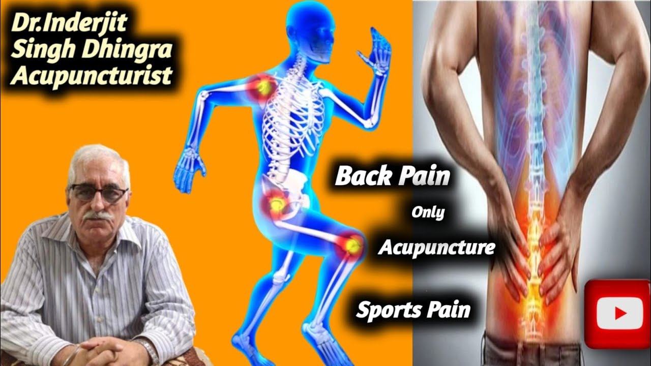 Acupuncture treatment best for back pain and sports injuries YouTube