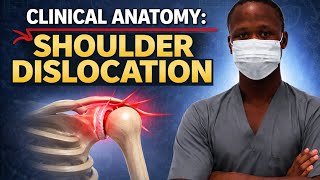 CLINICAL ANATOMY OF SHOULDER DISLOCATION | Explained Simply 