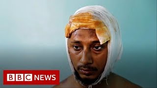 Delhi riots: 'No-one who saw the photo thought I would survive' - BBC News