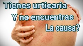 Mi experiencia con urticaria y sarpullido, por fin encontré la causa.