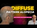 Hair transplant in india for diffuse pattern alopecia