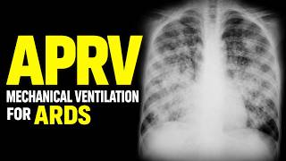 APRV in Severe ARDS | How to Set It, Adjust It & Wean It.