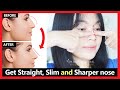 Get rid of hook nose  nose hump reduction naturally  get straight slim  sharper nose  exercises