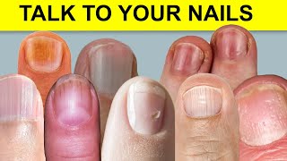 10 Things Your Nails Can Tell You About Your Health