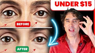 GET RID of YOUR UNDER EYE BAGS FOR GOOD !!