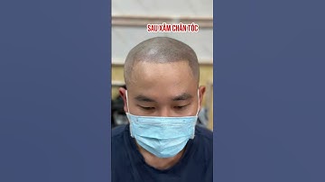 Hết hói chỉ sau 1 tiếng! Cú lột xác ngoạn mục nhờ xăm tóc SMP #reviewxămtóc