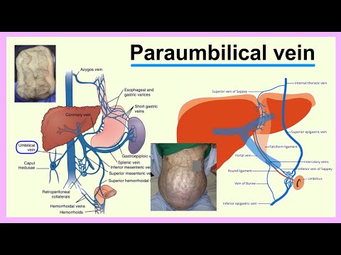 paraumbilical vein