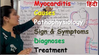 Myocarditis in Hindi | Causes | Pathophysiology | Sign. & Symptoms | Diagnosis | Treatment