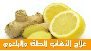 وصفة الدكتور جمال الصقلي لعلاج التهاب الحلق والبلعوم  مجربة