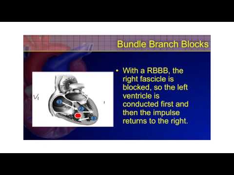 the-12-lead-ecg-course---3