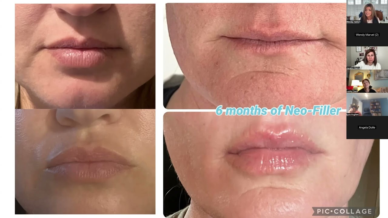 Neora with Gold NMD Wendy Hatton