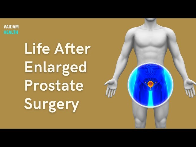 Life After Enlarged Prostate Surgery 