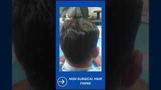 dr haircare hairreplacement