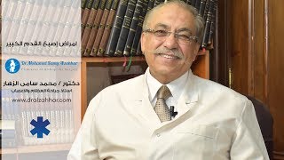 أمراض إصبع القدم الكبير - أستاذ. دكتور محمد سامى الزهار