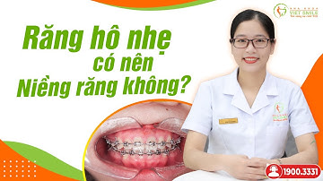 Răng hô nhẹ có nên niềng răng không? Bác sĩ giải đáp