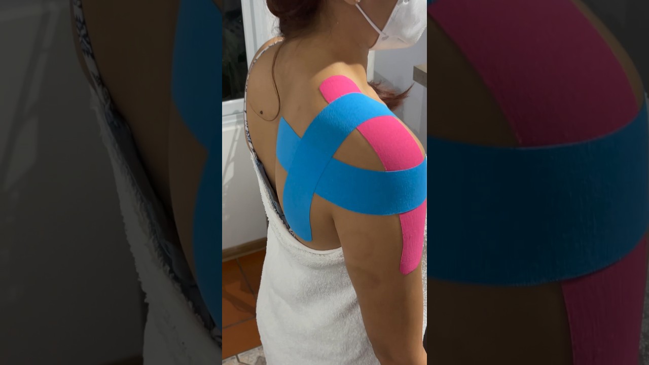 Кинезиотейпирование при болезненном плече.