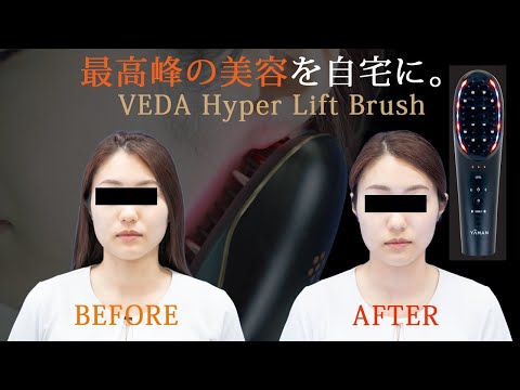 自宅で本格リフトアップ！YAMANのブラシ型美顔器ヴェーダ
