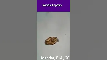 Fasciola hepatica ova 🤔😲