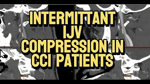 IJV Compression in CCI is Due to C1-C2 Instability