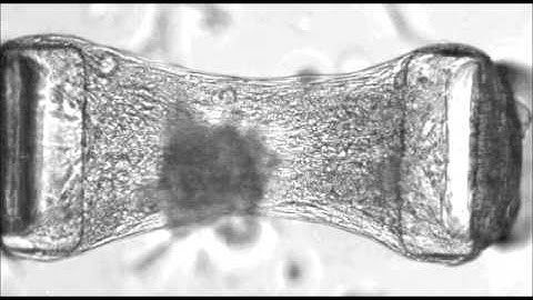 Formation and optogenetic control of engineered 3D skeletal muscle bioactuators