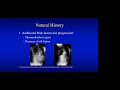 Congenital Scoliosis presented by Burt Yaszay, MD on March 28, 2022.