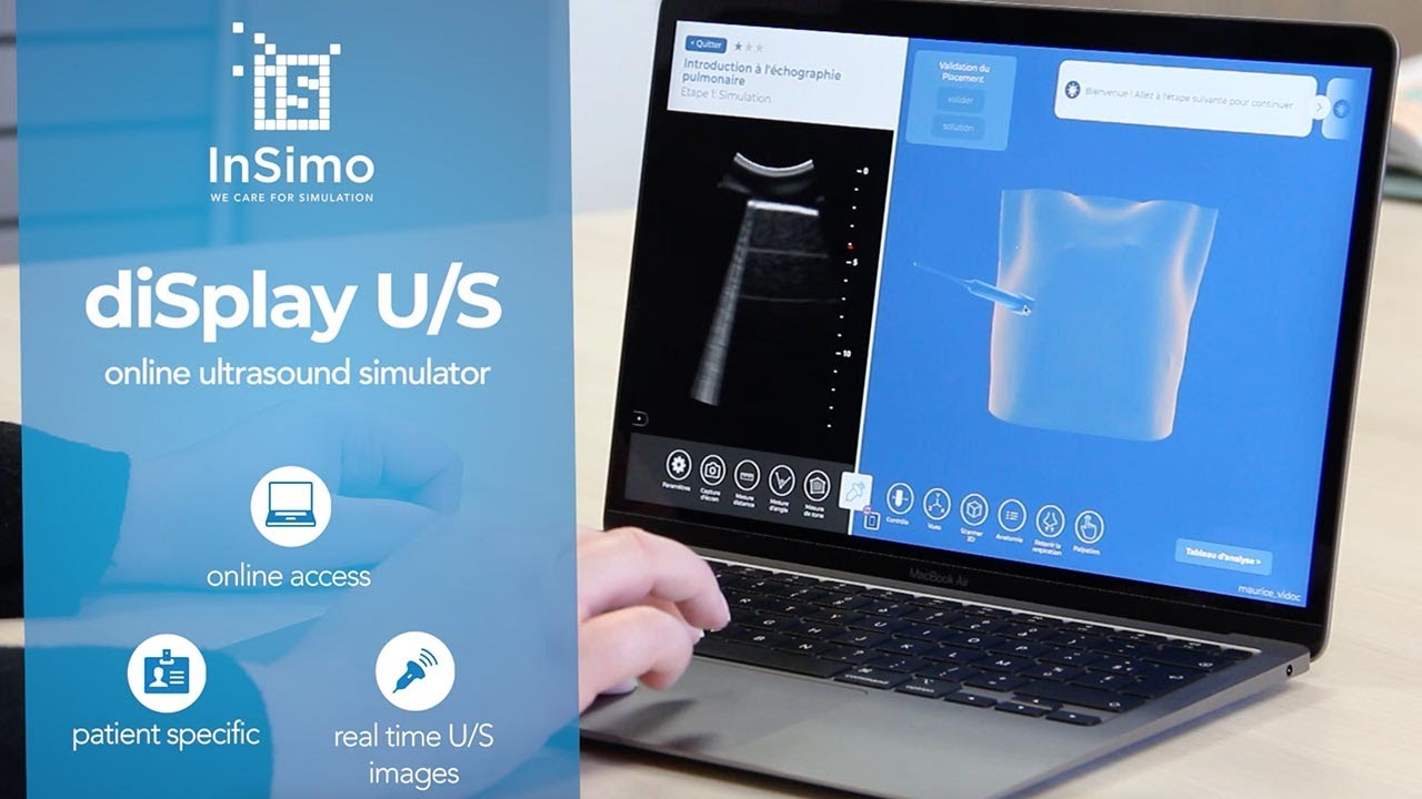 Display U S Online Ultrasound Simulator By Insimo
