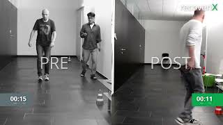 Before/After recoveriX - MS - T25FW - MS2