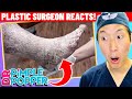 Plastic Surgeon Reacts to DR. PIMPLE POPPER: Feet of STONE?!?