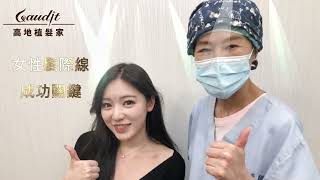 女性髮際線植髮1300根搞定!國旗女孩kiki術後一年分享植髮成功關鍵(完整版)【林宜蓉醫師 高地植髮家診所】