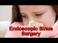 Functional endoscopic sinus surgery | FESS | Endoscopic Sinus Surgery for Block Nose