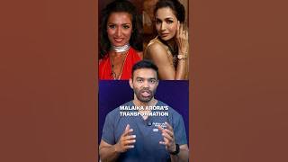 Which plastic surgeries Malaika Arora has undergone?