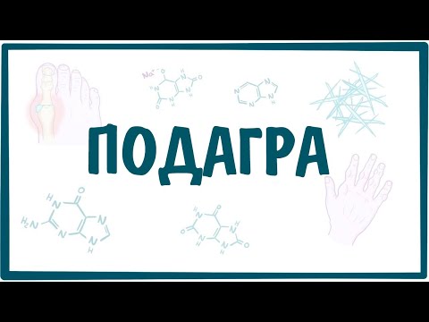 ПОДАГРА — причины, симптомы, патогенез, диагностика, лечение