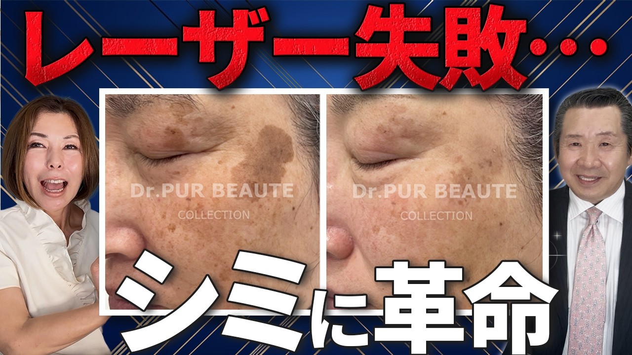 Professional Technique] What is the surprising new method for