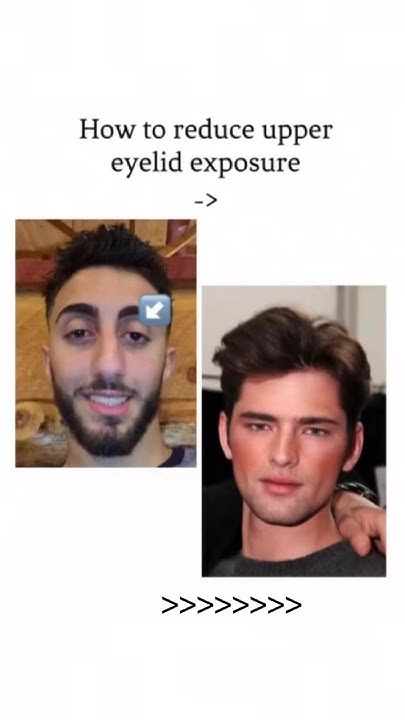how-to-reduce-upper-eyelid-exposure-tips-eyes-eyemakeup