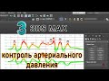 3ds max контроль артериального давления