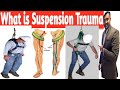 What is Suspension Trauma | Symptoms | Suspension Trauma Safety Straps | WAH @SafetyTrainerNebosh