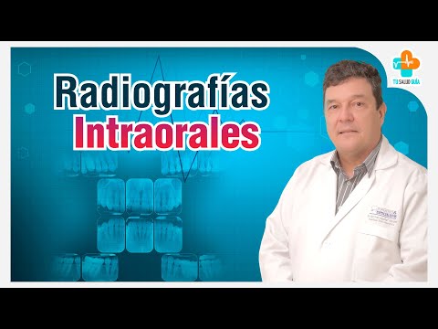 Radiografías Intraorales | Tu Salud Guía