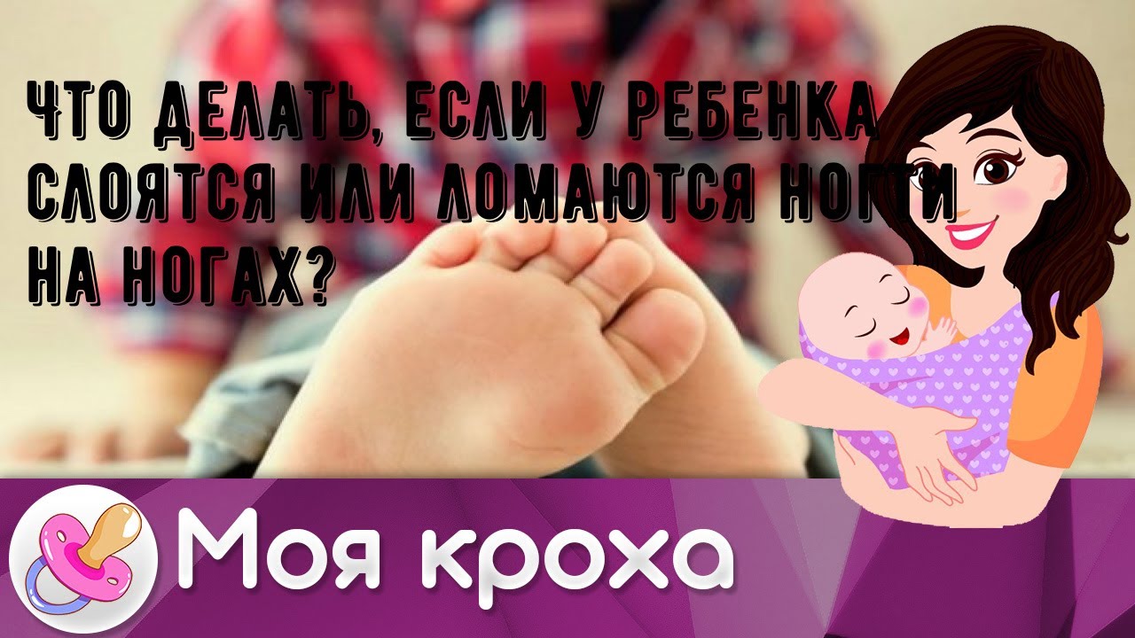 Что делать, если у ребенка слоятся или ломаются ногти на ногах?