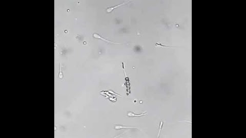 Amazing technology. A motorized nanobot helping a sperm with motility issues along towards an egg