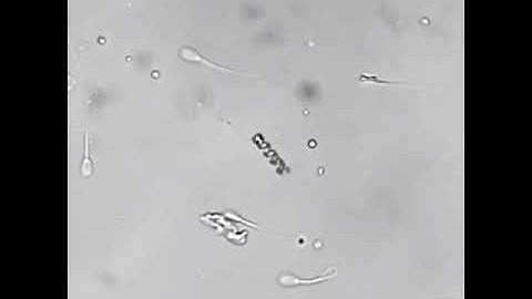 Amazing technology. A motorized nanobot helping a sperm with motility issues along towards an egg