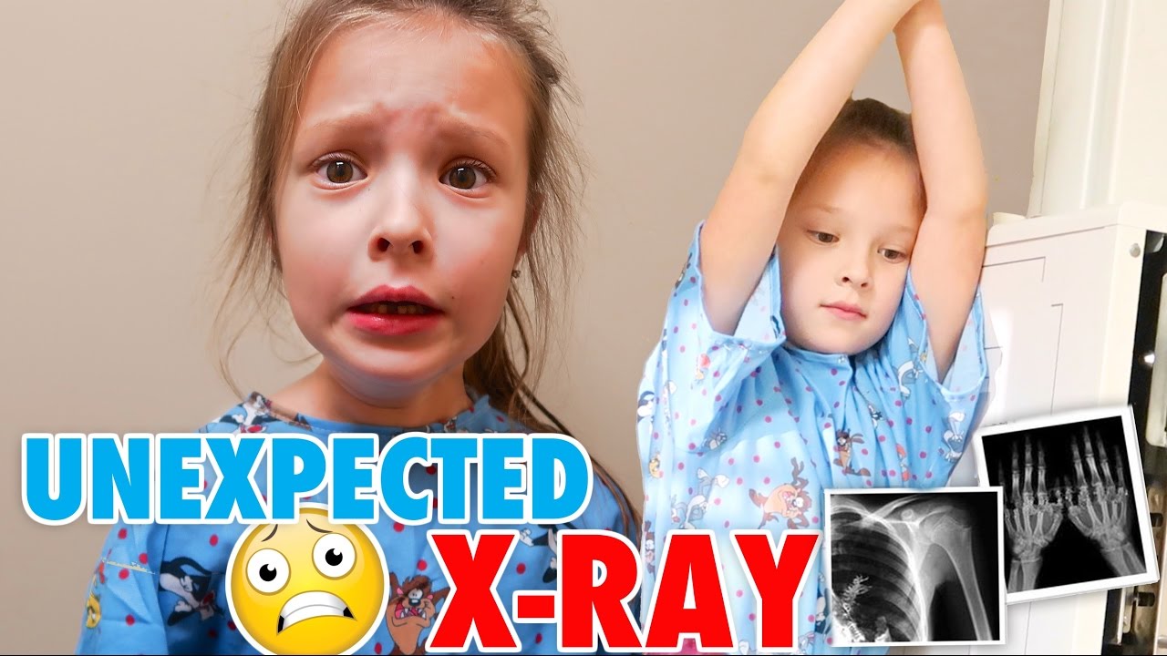 KIDS UNEXPECTED X-RAY! 💀