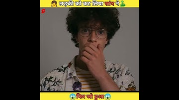 Experiment ➡️ लड़की को कट लिया सांप ने🐍😱😱 #shorts #ytshorts