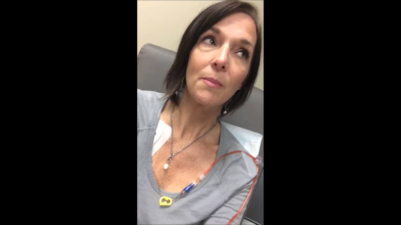 cytoxan infusion Second Chemo infusion