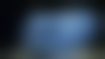 Titanium Mesh Placement (Dr Jaw Breaker)