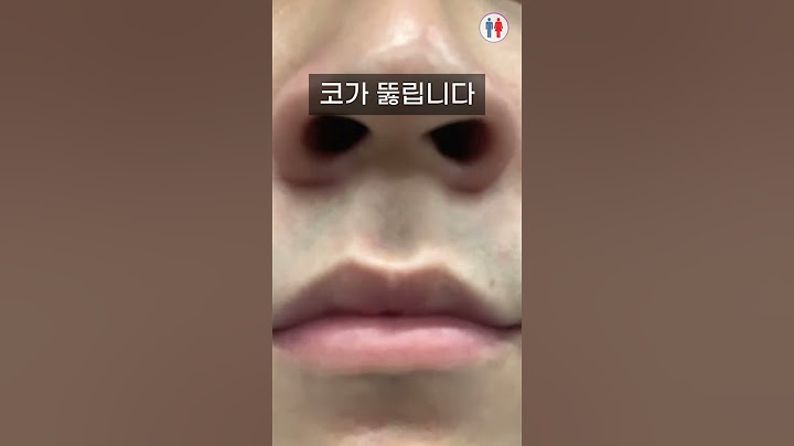 [1500만] 코가 막혔을 때... 30초 안에 뚫는 법 (미쳤다... 공유해야지)
