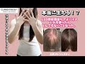 【5年後の髪の毛ある?】抜け毛女が感動したアイテム紹介🥹✨