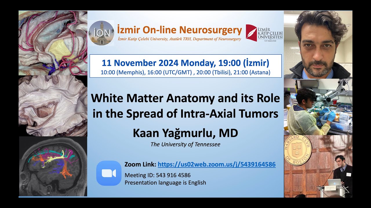 İON 481. Lecture, Yağmurlu: White Matter Anatomy and its Role in the Spread of IIntra-Axial Tumors