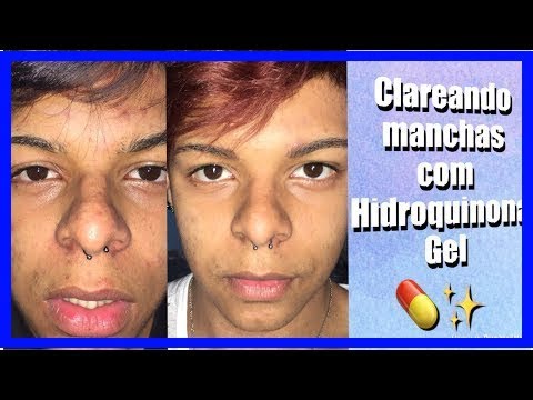 Hidroquinona para que sirve